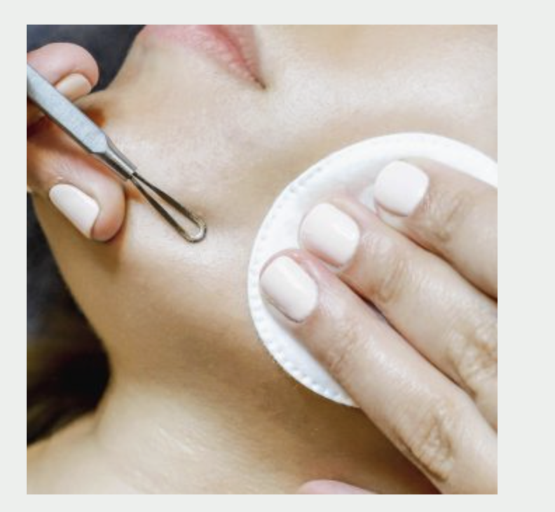 Acne and Breakouts